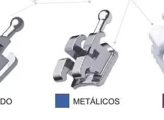 Brackets Autoligantes Autoligado Roth Eksen 0,22 Torque