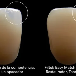 Kit Composite universal Filtek Easy Match, 3 jer. x 4g. 3M